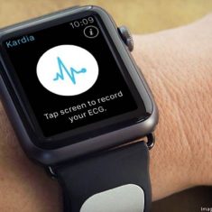 Alivecor Kardia Band